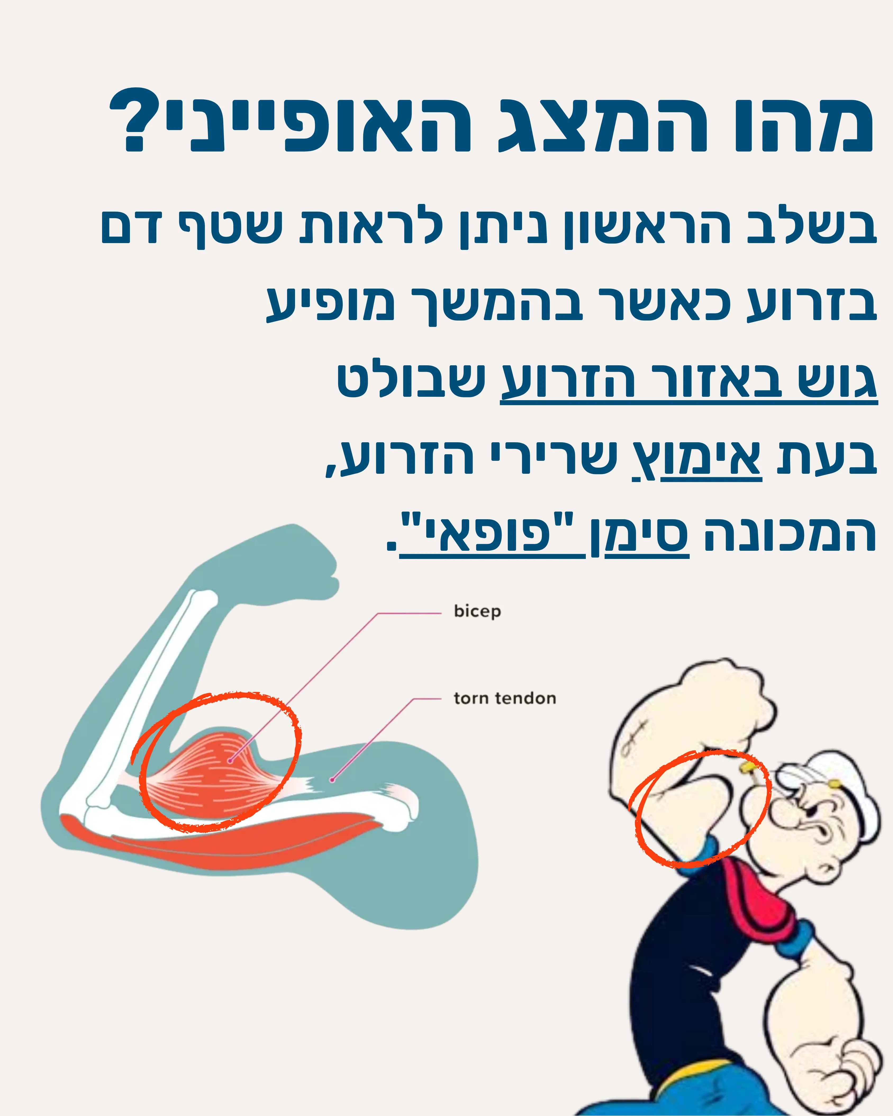 קרע בראש הארוך של השריר הדו ראשי - תמונה 3