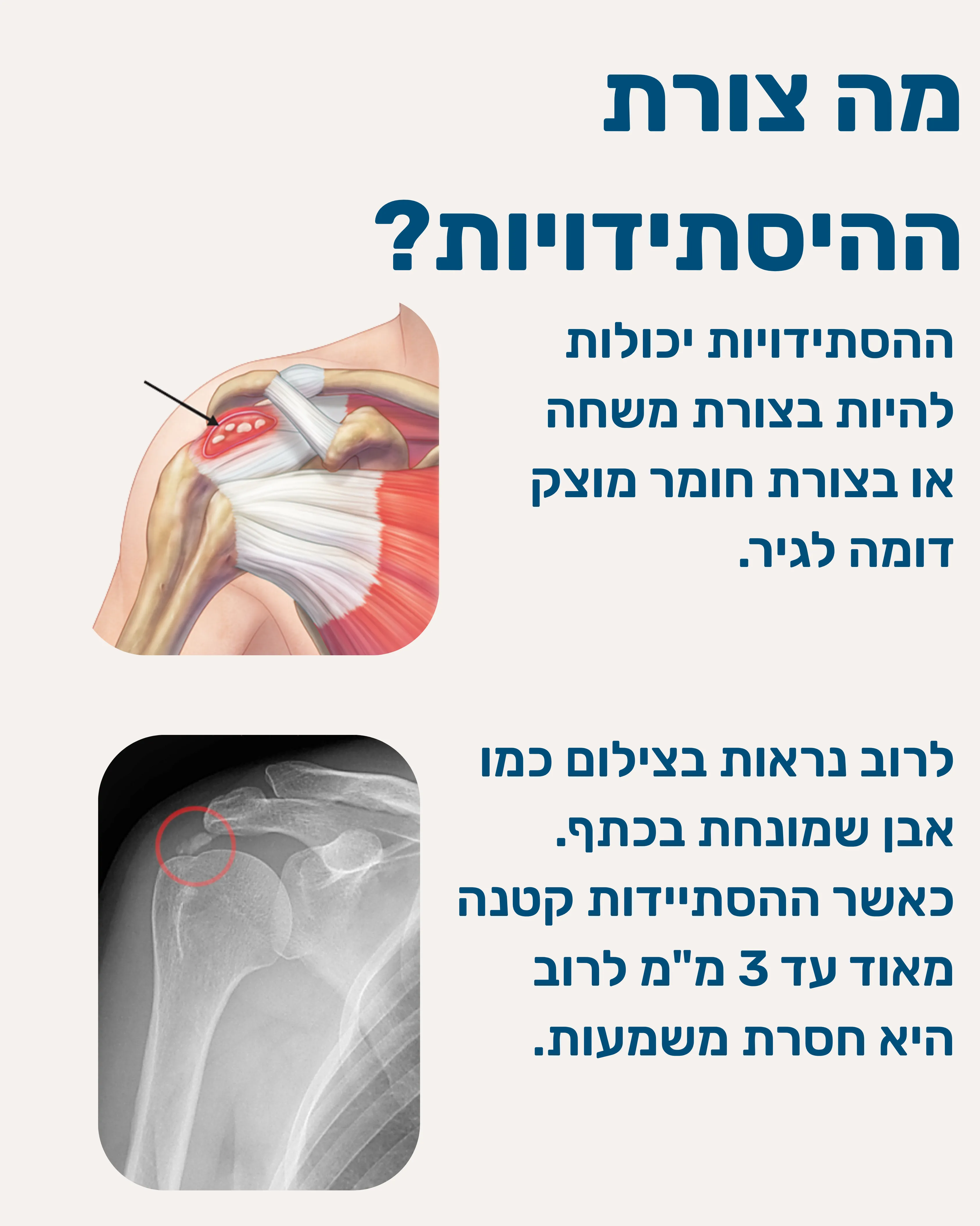 הסתיידויות בגידים - תמונה 4