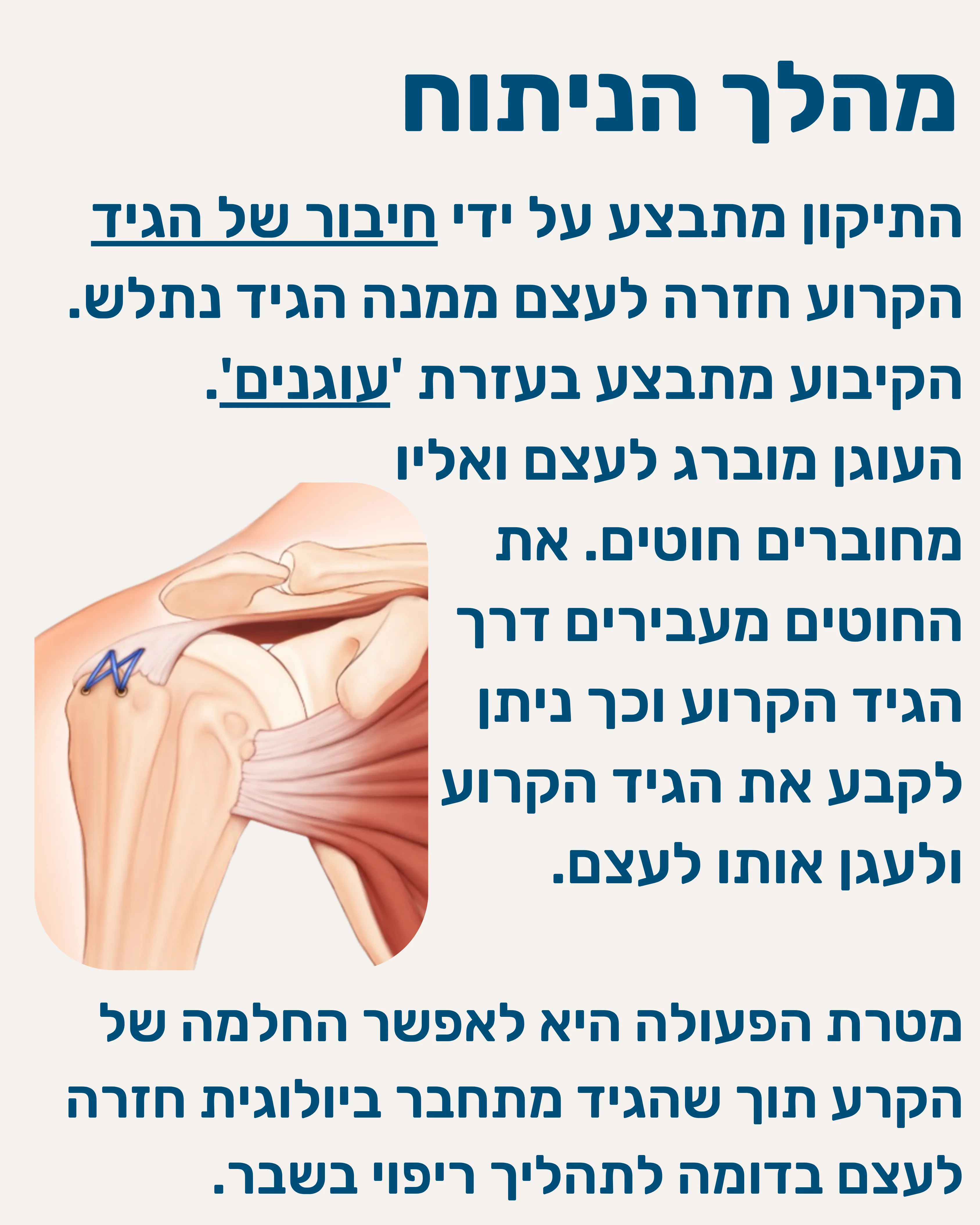 תיקון קרע בגידים שרוול מסובב - תמונה 6