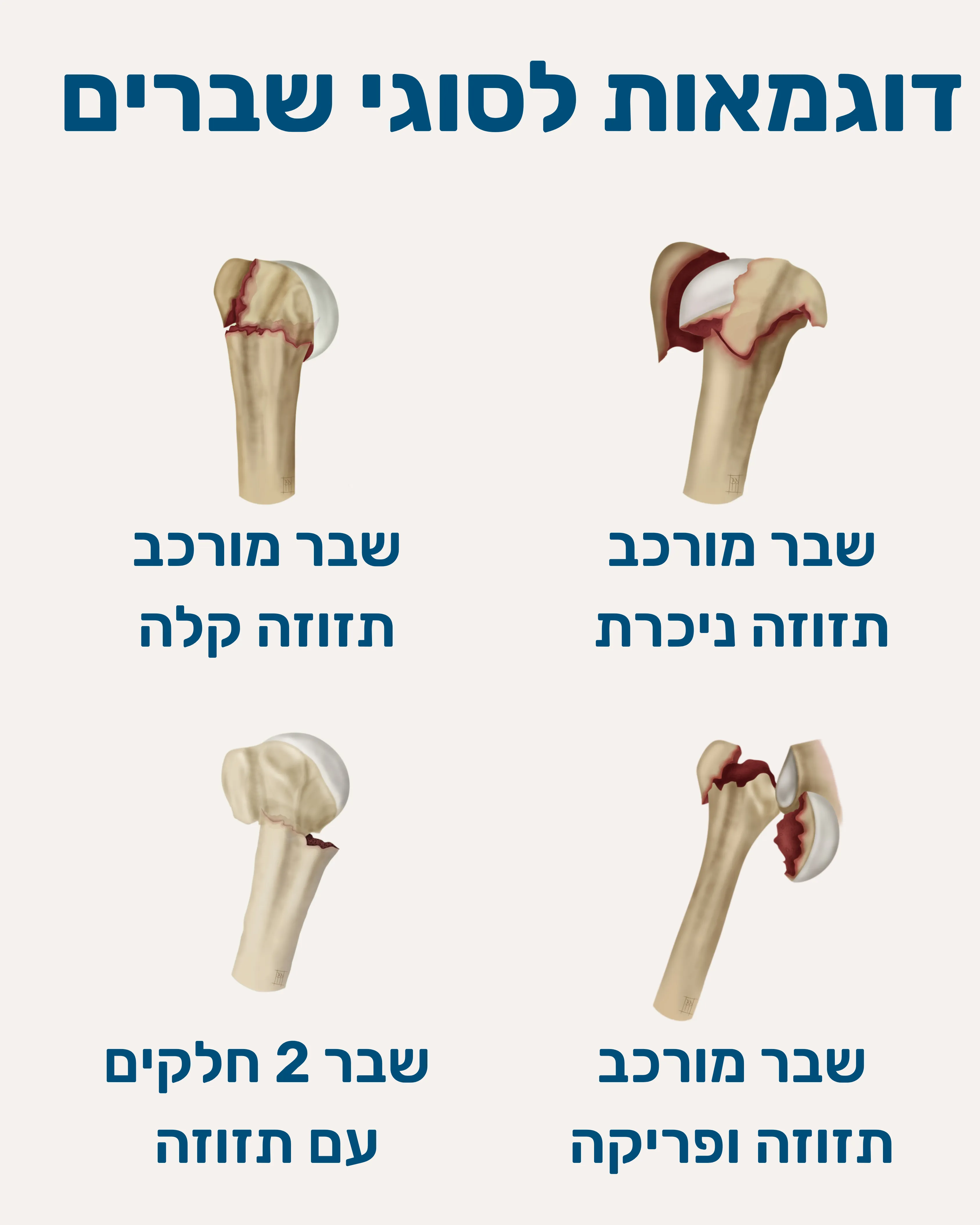 שברים בכתף עצם הזרוע - תמונה 5