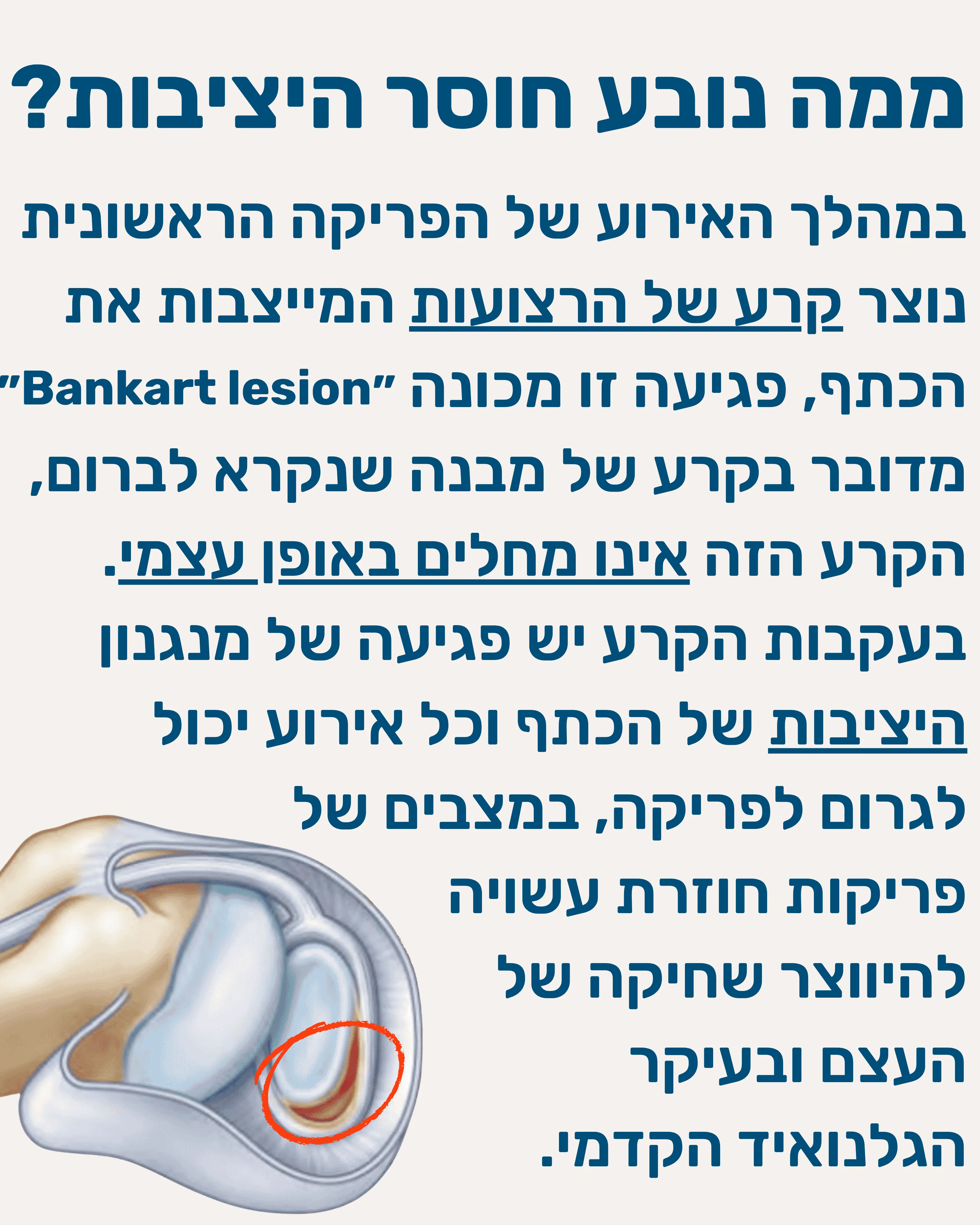 פריקות חוזרות, חוסר יציבות בכתף - תמונה 7