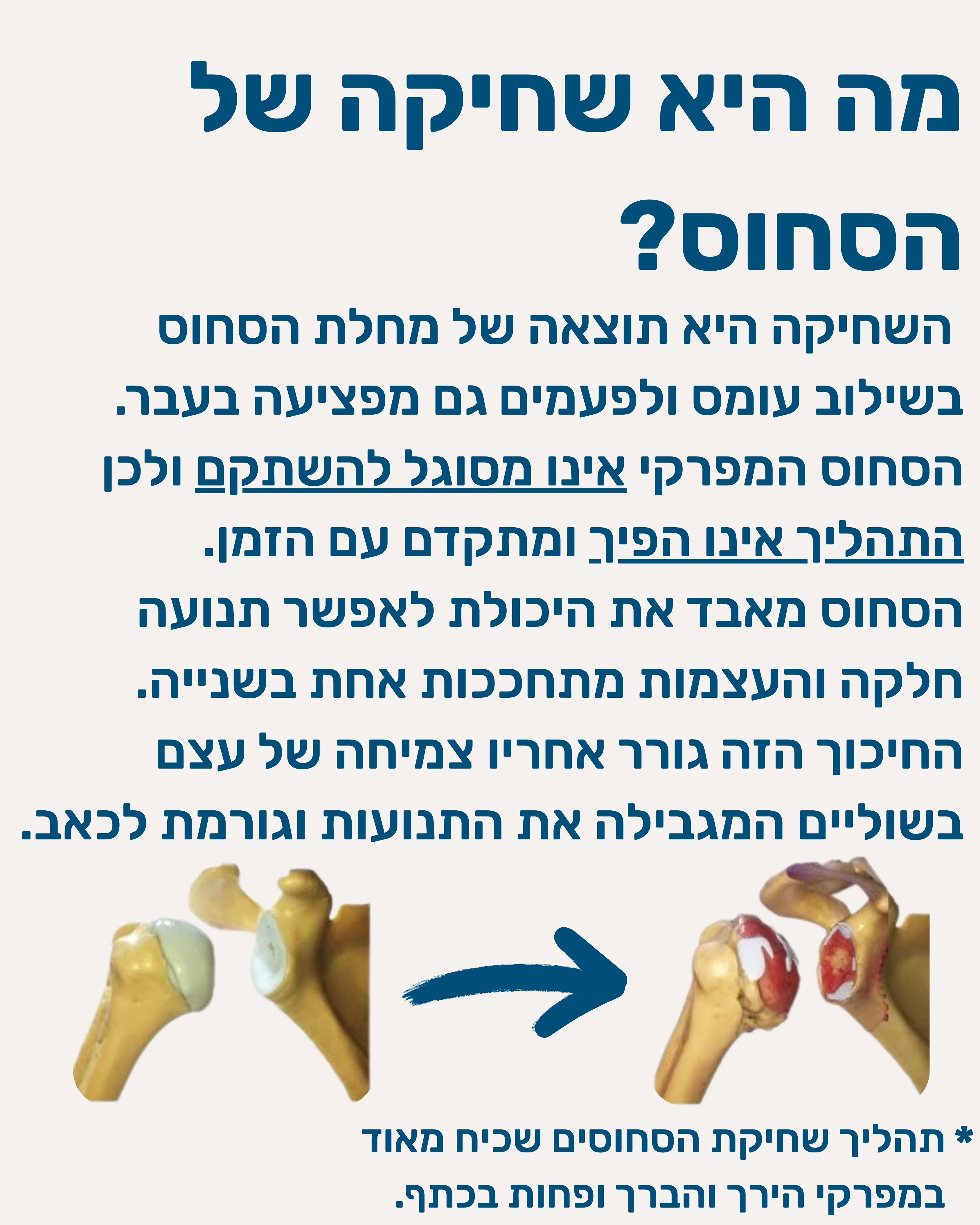 שחיקת סחוס במפרק - תמונה 3