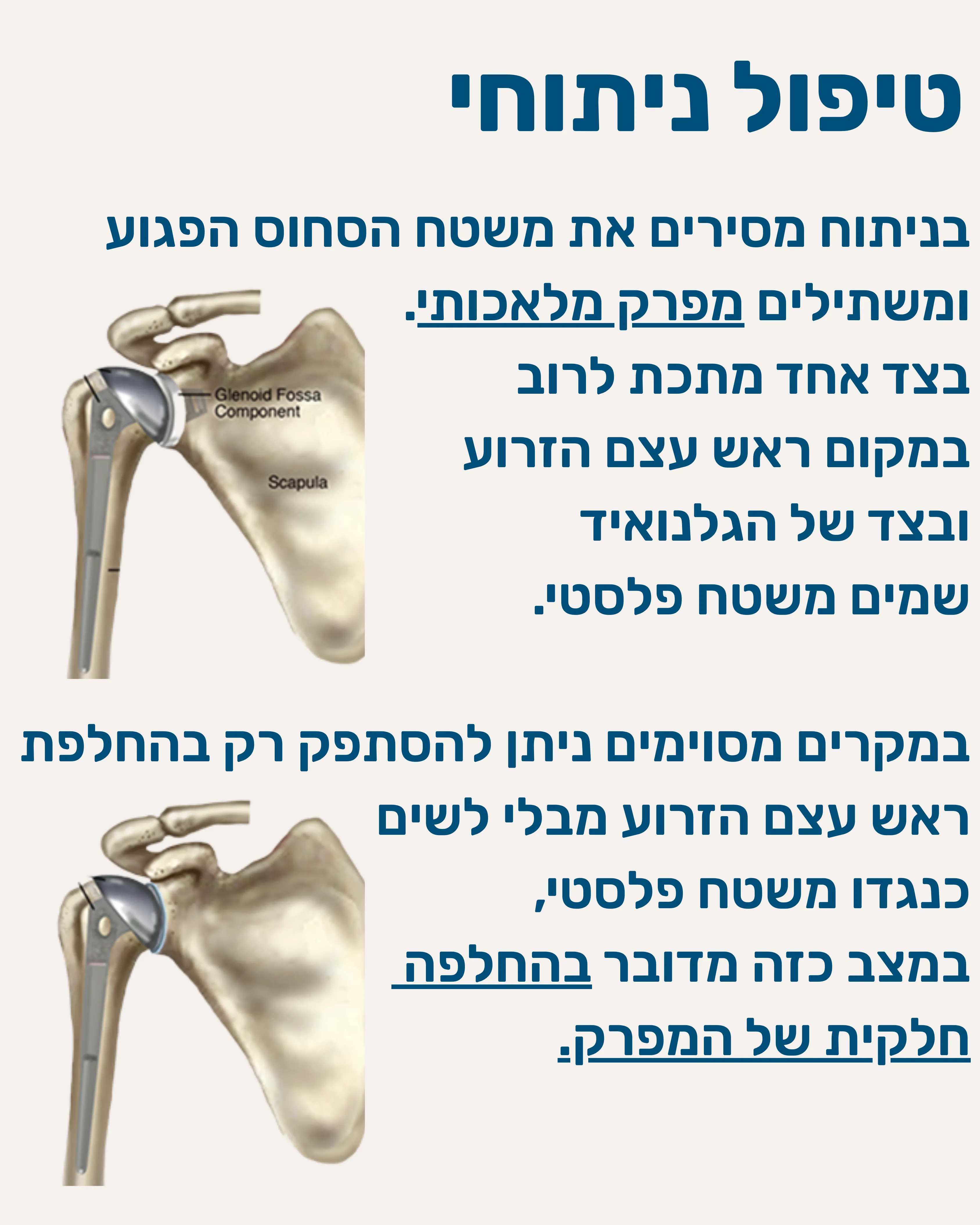 שחיקת סחוס במפרק - תמונה 8