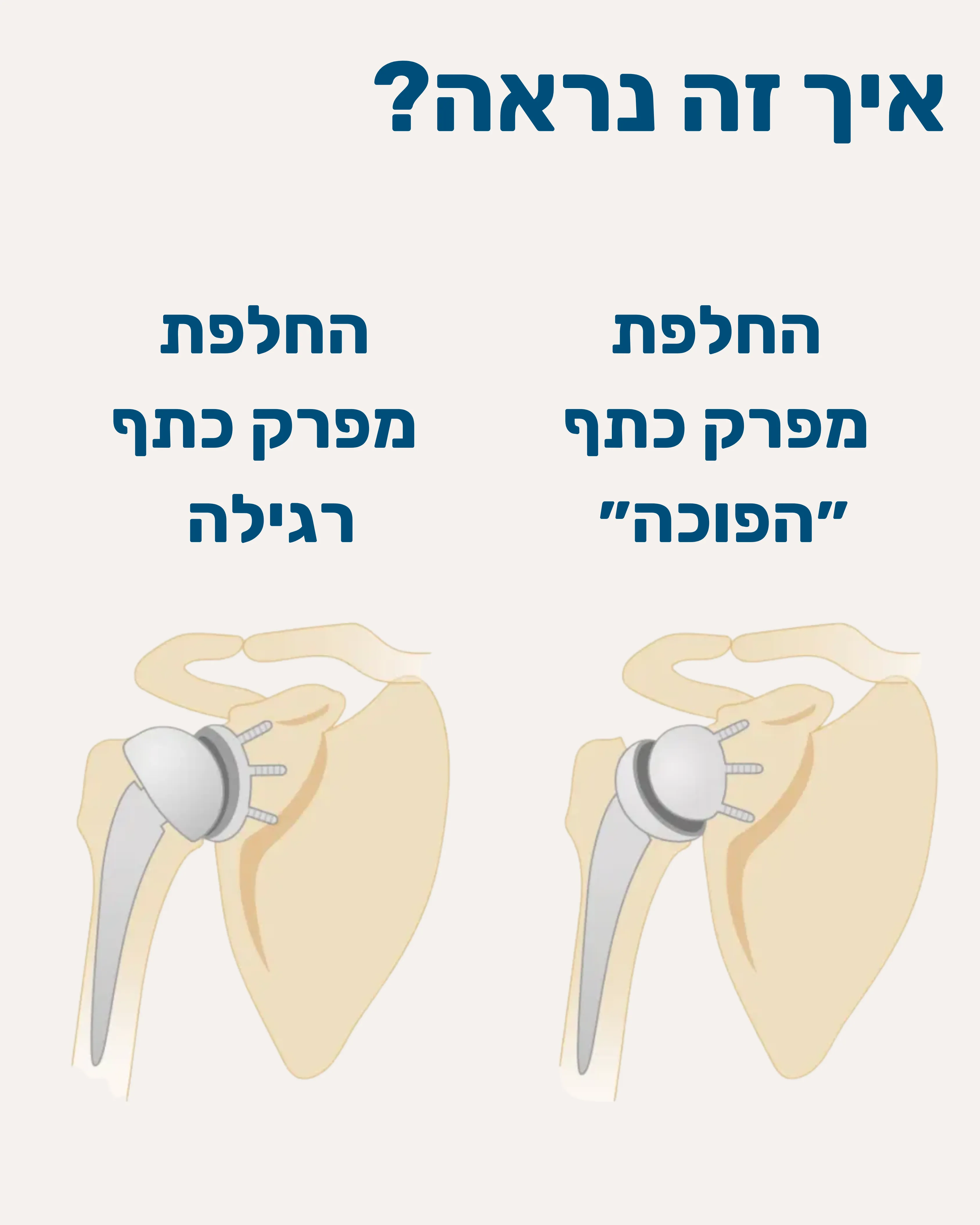 החלפת מפרק כתף הפוכה - תמונה 3