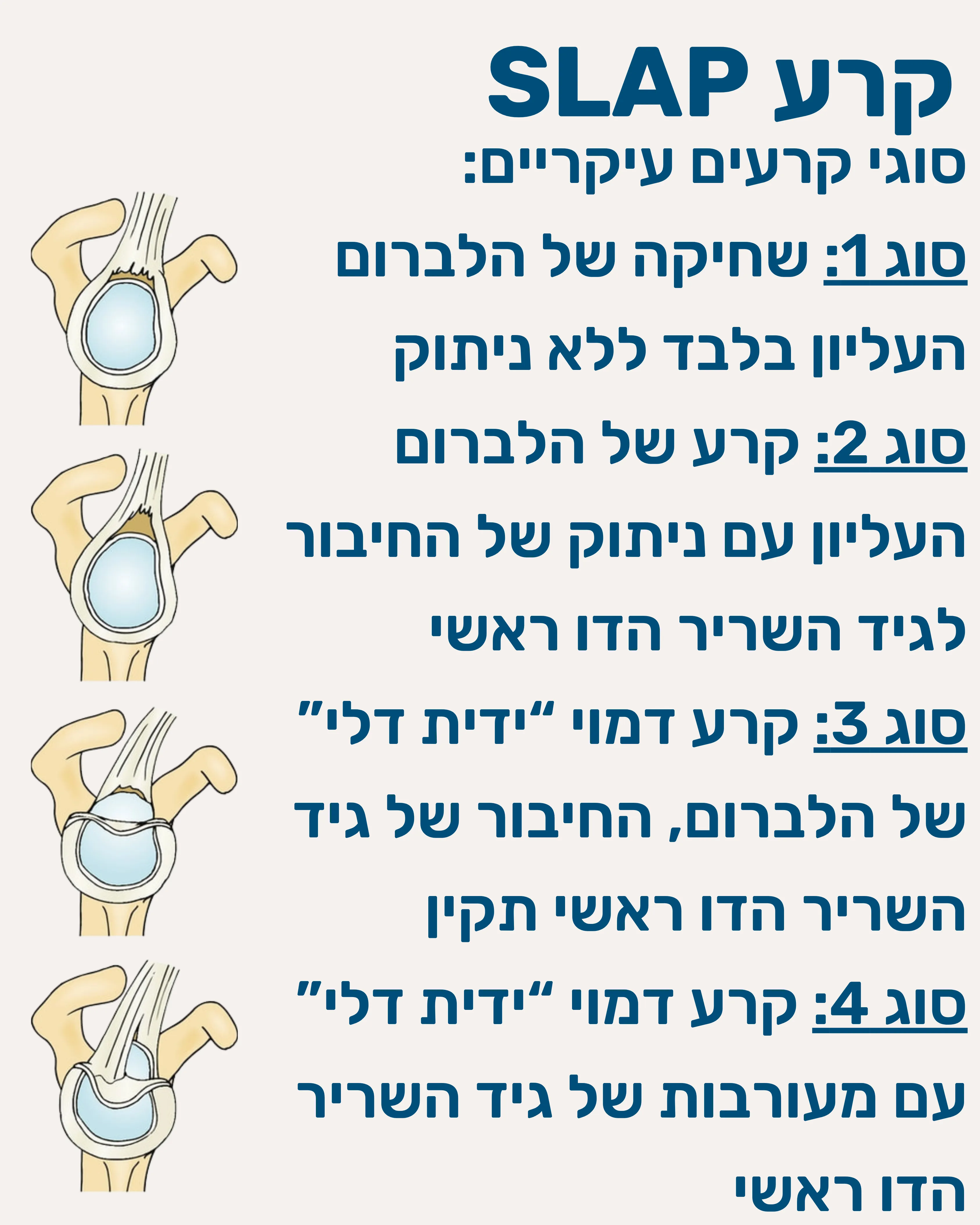 קרע בלברום העליון SLAP - תמונה 5